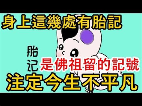 大腿胎記|【胎記是什麼】胎記的秘密大公開！從產生原因、消除。